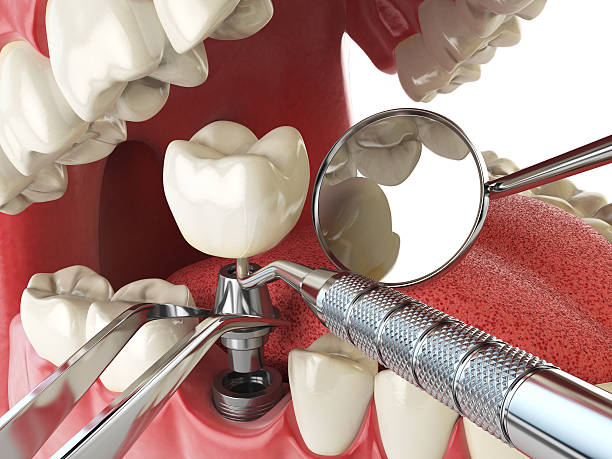 Best Emergency Dental Care for Broken or Chipped Teeth in Alamo, NV
